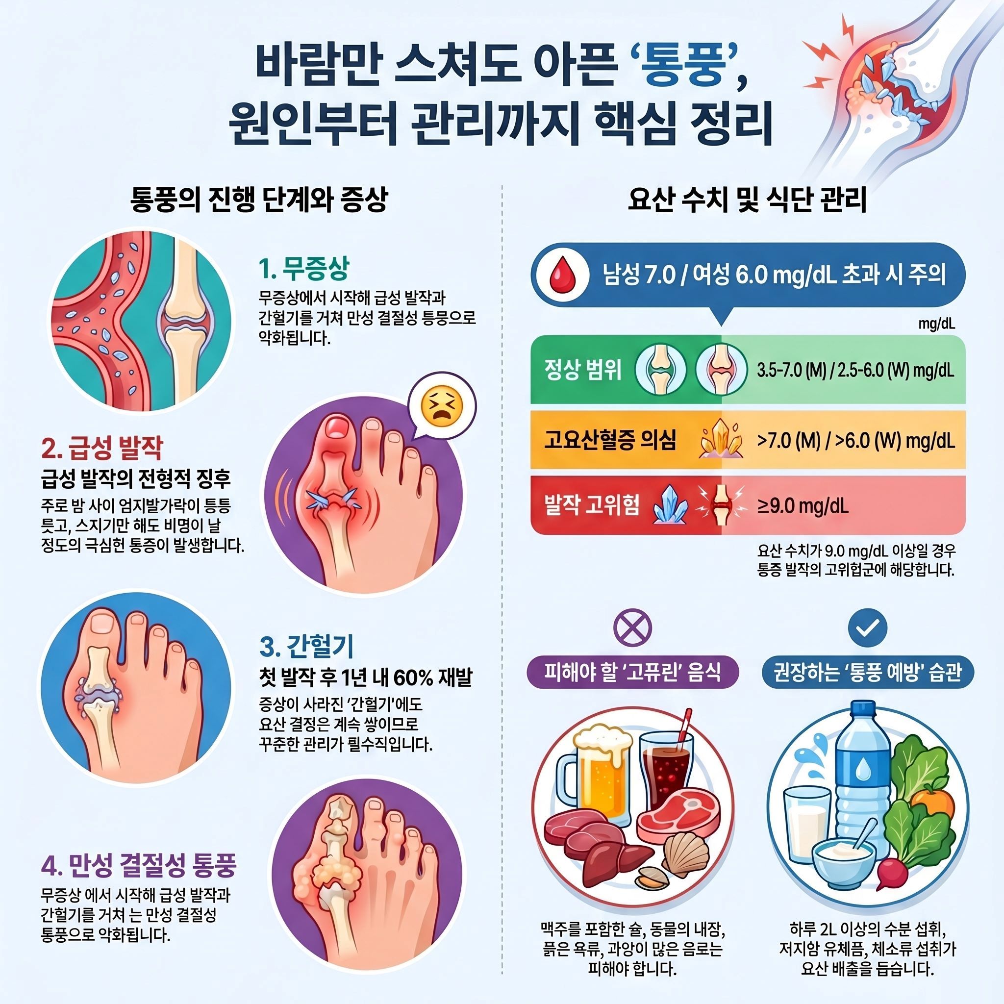 이 인포그래픽은 통풍의 진행 단계와 요산 수치 관리 방법을 네 가지 영역으로 나누어 설명하고 있습니다.