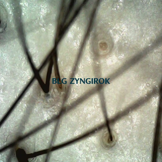 탈모 극복 프로젝트 - 정수리와 이마 사이 두피 모습이다.