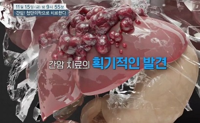 간암획기적인발견