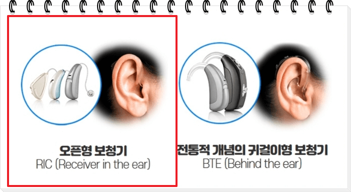 오픈형 보청기 특징 가격 장단점 비교추천