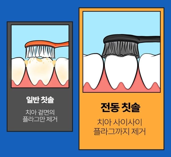 전동칫솔 고르는법 음파식 회전식 비교