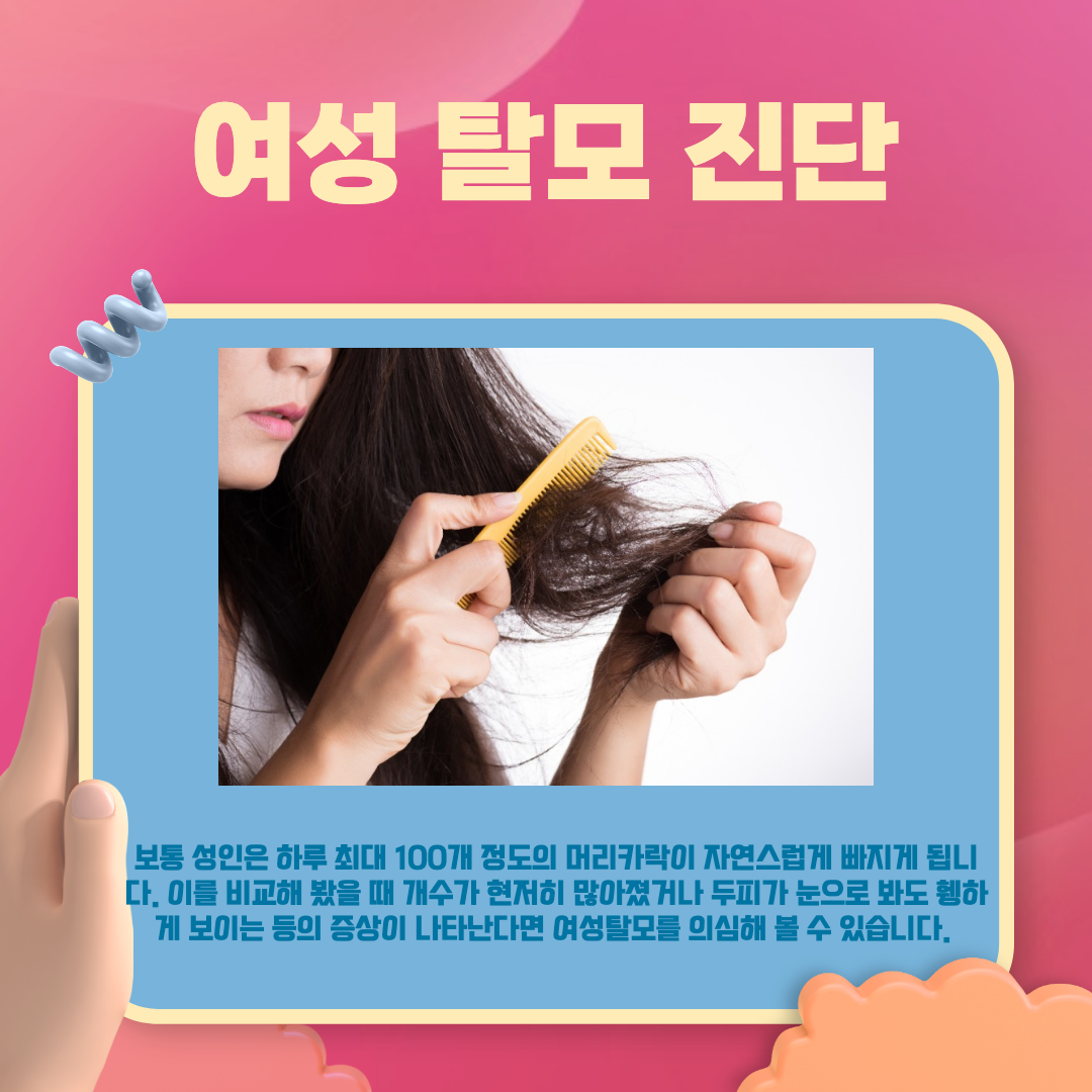 여성 탈모 진단.