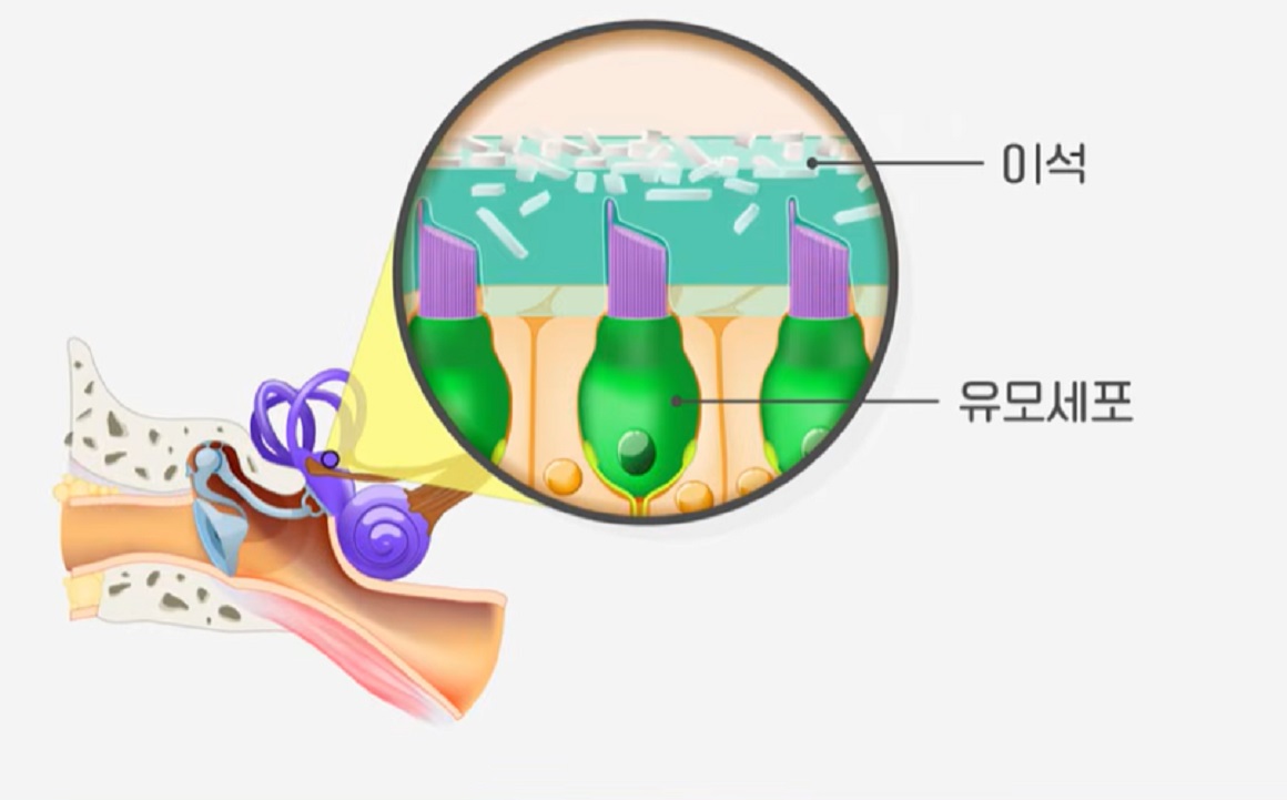 반복되는-어지럼증-서재현-교수