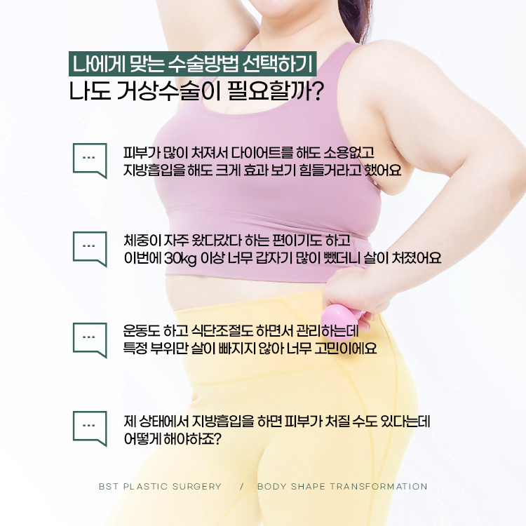 거상수술이 필요한지 확인할 수 있는 체크리스트