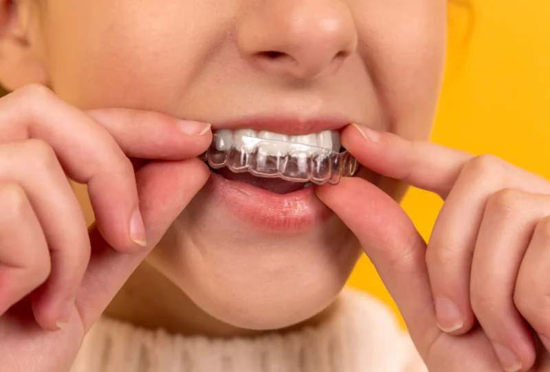 치간칫솔 좋은점