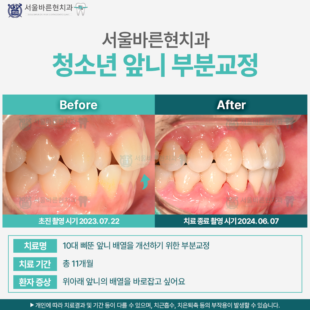 부산청소년교정