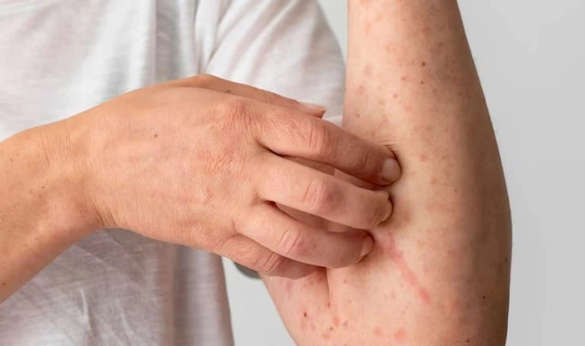 대상포진 병원 예방접종 가격