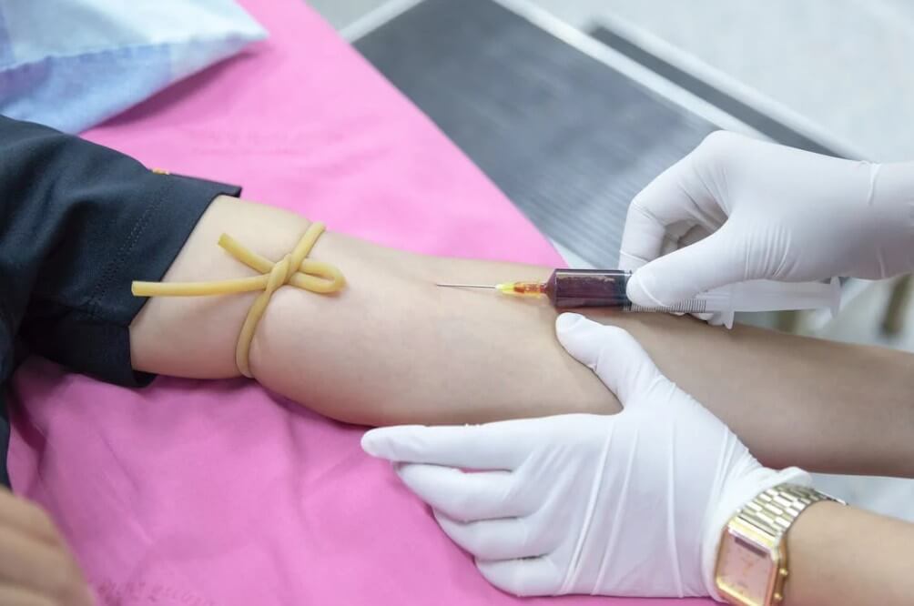 혈액-샘플을-채취하는-모습