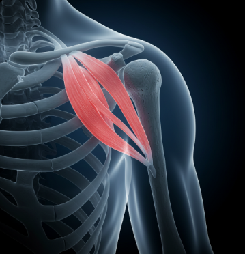 회전근개파열 증상 및 치료법2