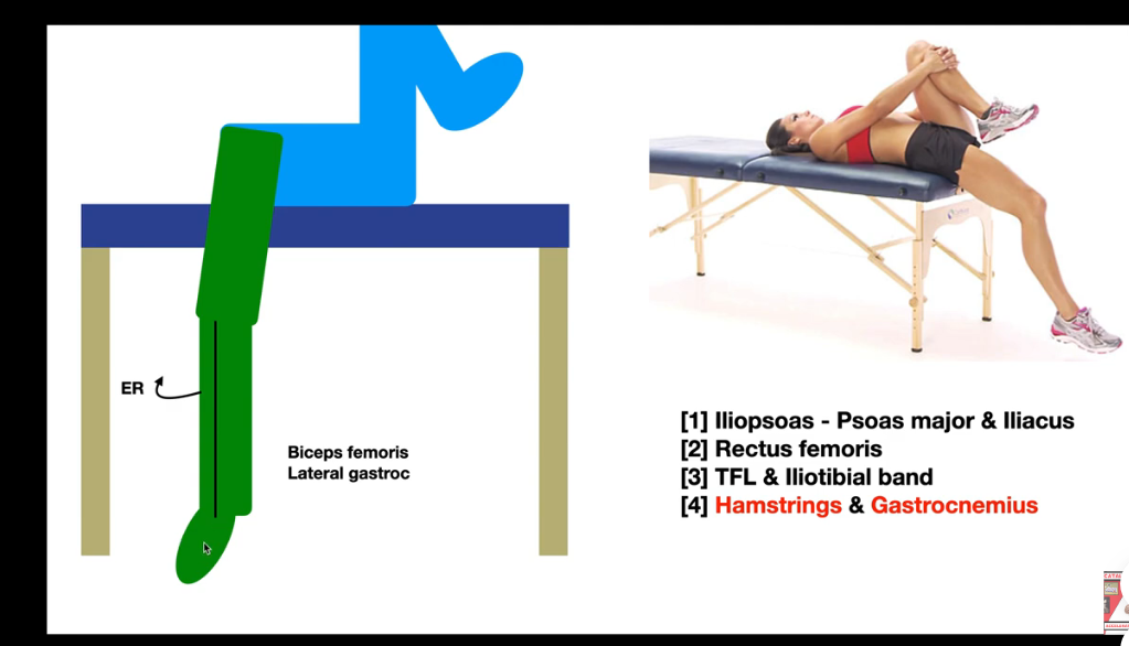 과도한 외회전 (External Rotation): 정강이뼈 선