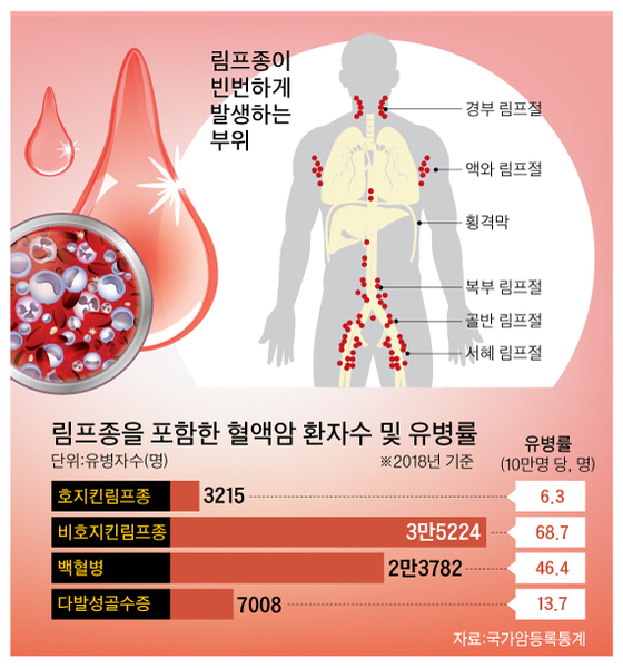 혈액암