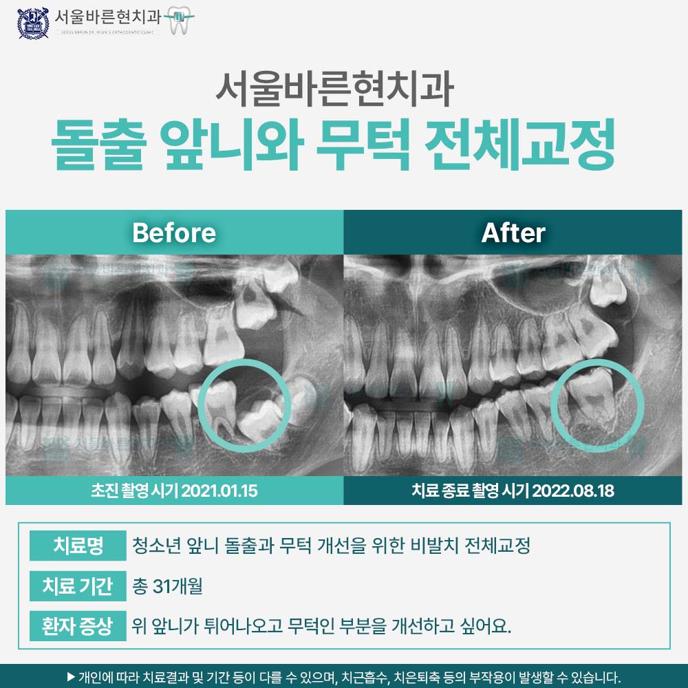 해운대교정치과