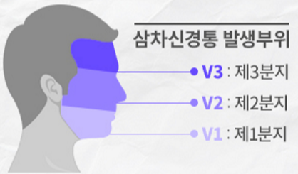 삼차신경통 발생부위