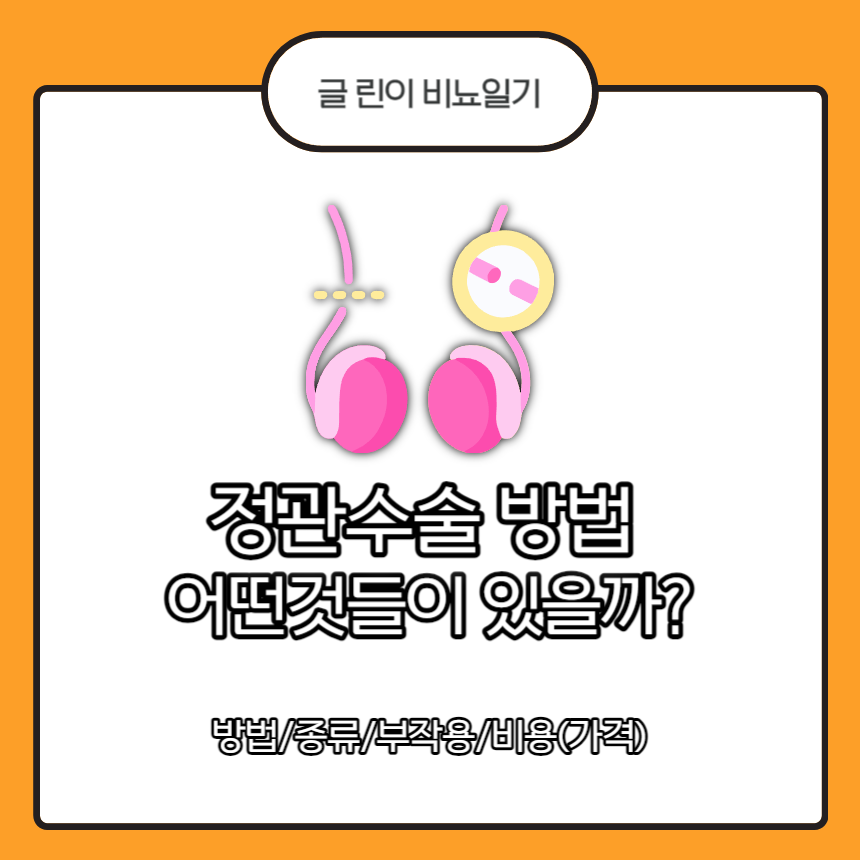 정관수술 방법