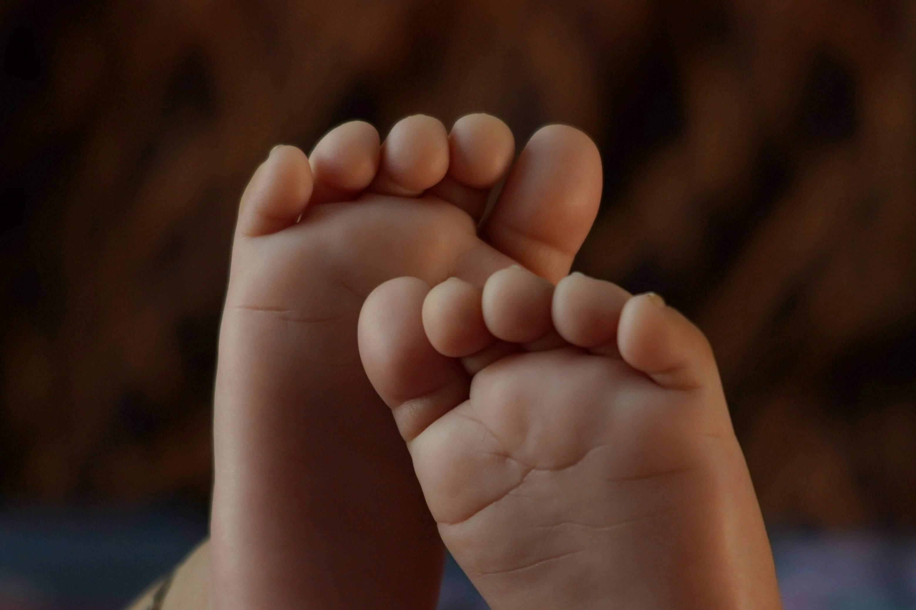 무지외반증 수술비용