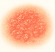 피부가려움증의 원인