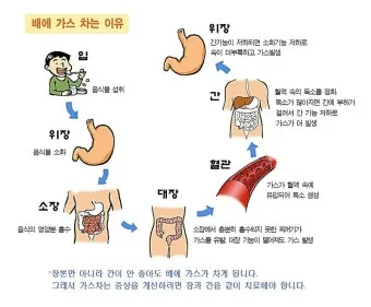 배에 가스가 차고 방귀를 자주 뀜 원인부터 해결책까지 한번에 알아보기_2