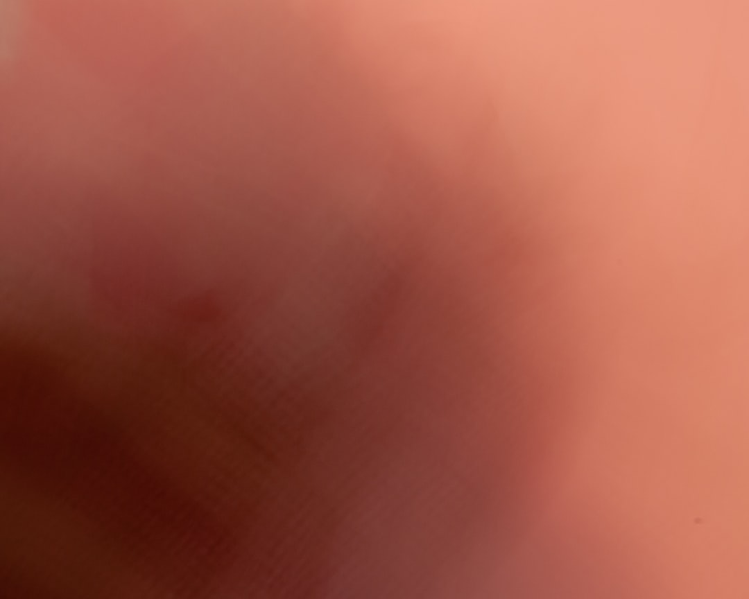 Seborrhea