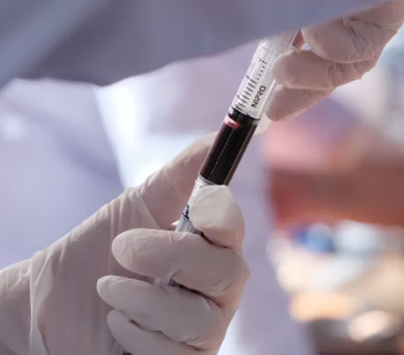 간경변증 치료방법 진단기준 합병증