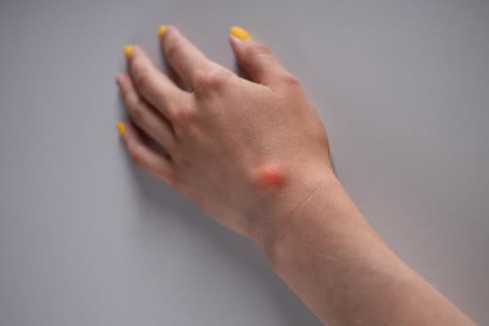 점액낭종 (Mucocele)의 원인과 치료