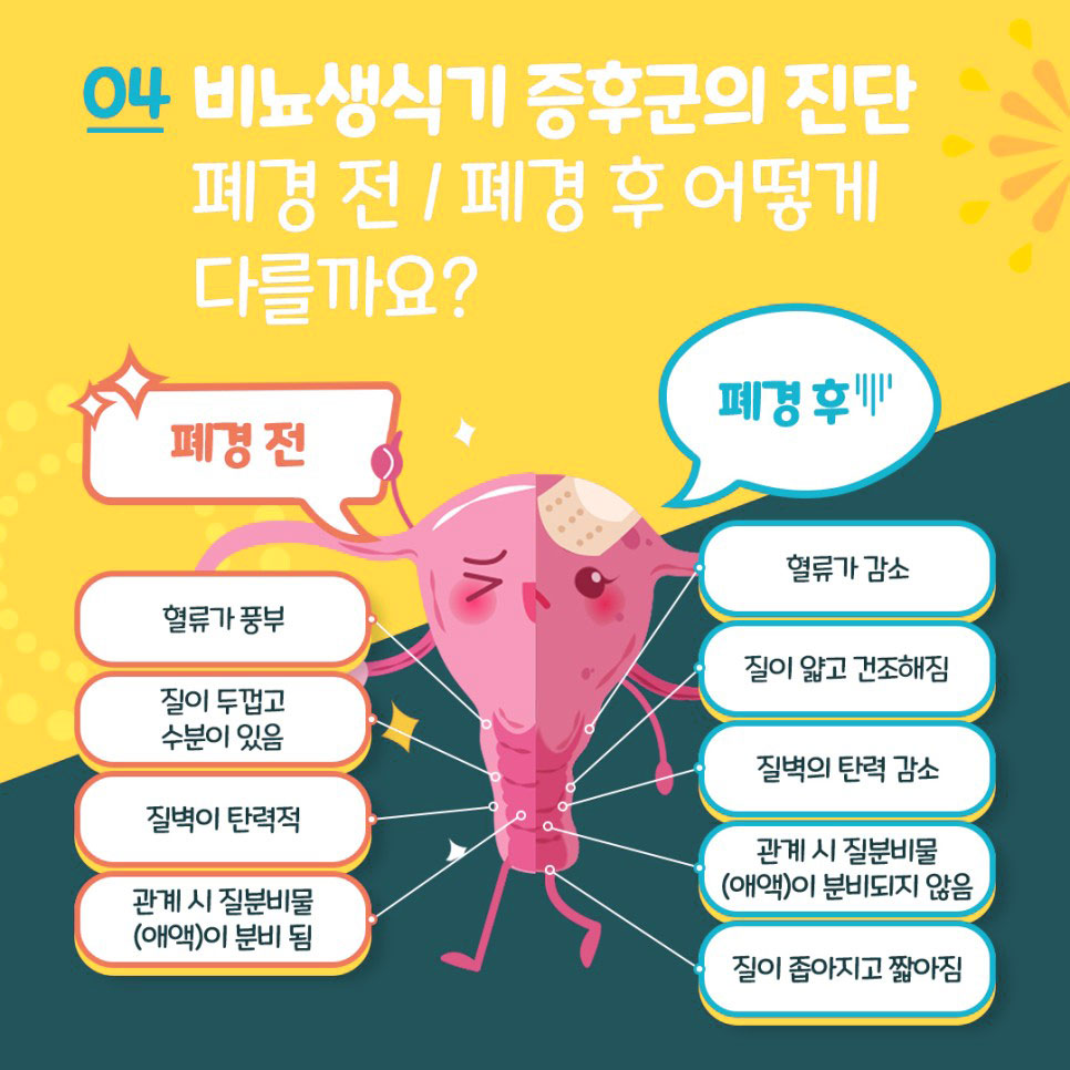 헤스티아여성의원
외음부위축증
비뇨생식기증후군