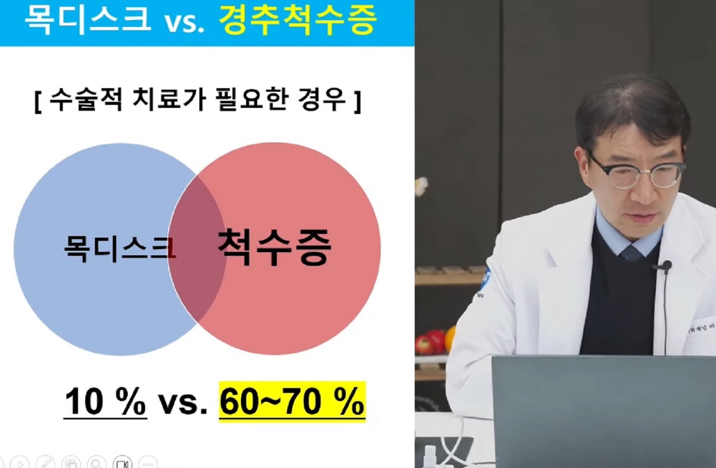 목디스크-경추척수증-명의-강경중