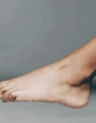 티눈 없애는 방법