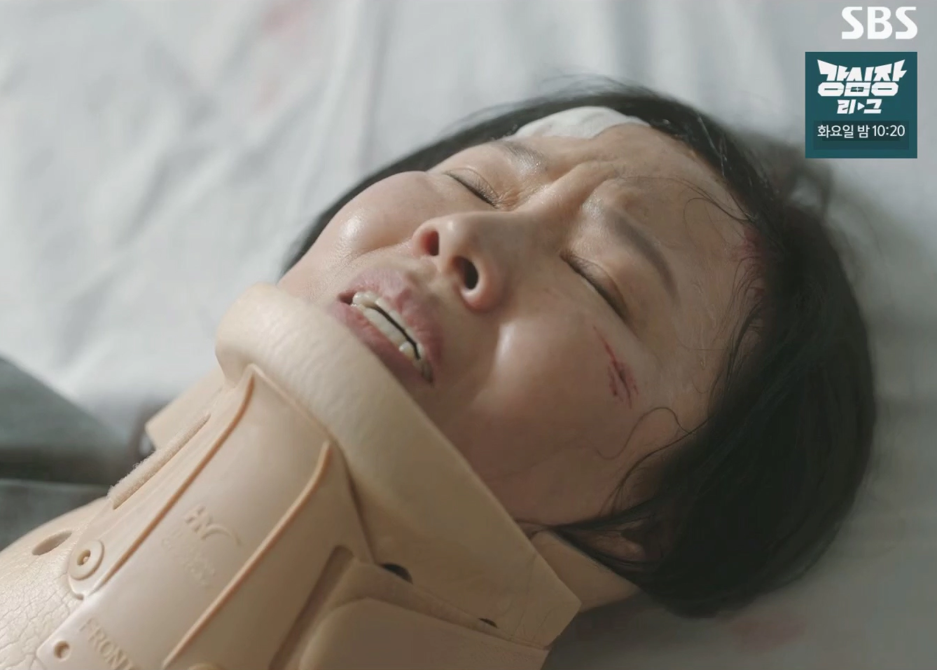 구획 증후군 증상 진단 치료 및 김사부3 구획증후군