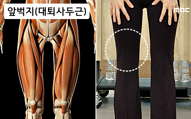 앞벅지 운동법, 무릎통증에 좋은 운동, 무릎 아플때 하는 운동, 건강 팁줌 매일꿀정보