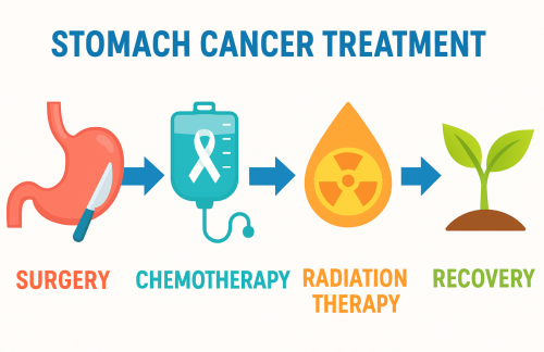 장형 위암 치료 가이드