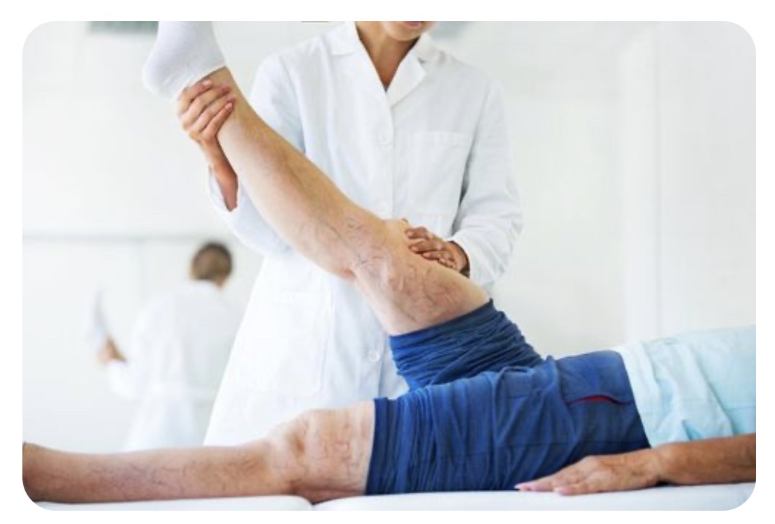 하지정맥류 치료 및 예방법