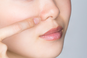 콧속에 여드름이 생기는 원인