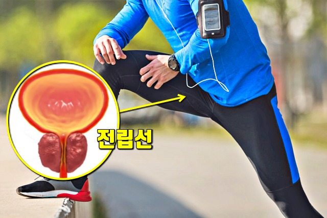 배일호 전립선 비대증, 생로병사의 비밀, 보폭 10cm 더 넓혀 걷기 운동 효과, 건강, 팁줌마 매일꿀정보