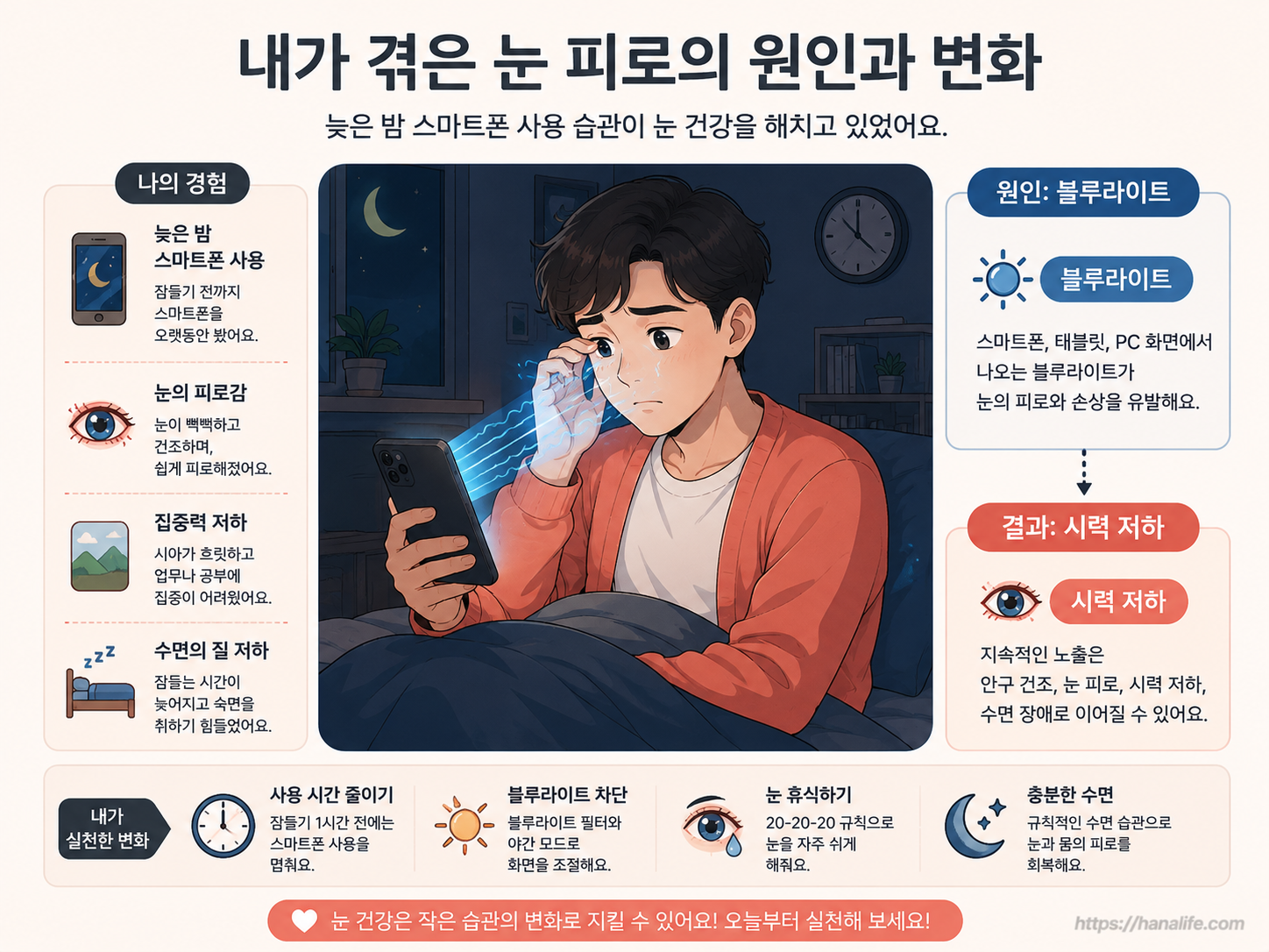 어두운 방에서 스마트폰 화면의 블루라이트가 안구 망막에 직접 자극을 주는 유해성 일러스트