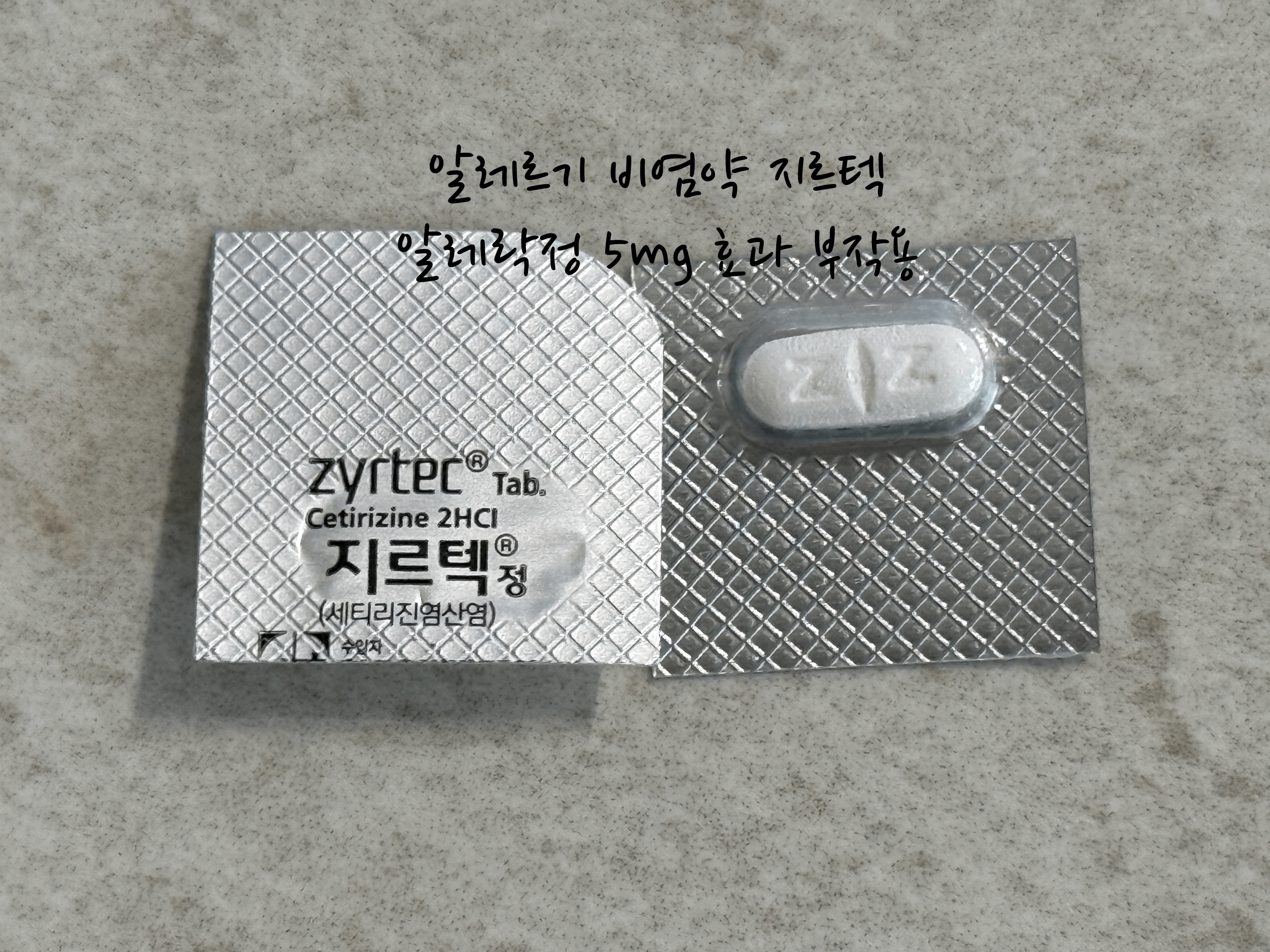 알레르기 비염