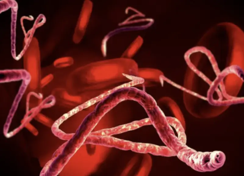 에볼라-바이러스