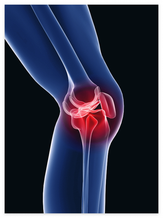 콘드로이친 효능