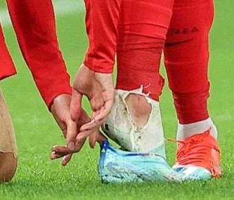 손흥민 안와골절 마스크