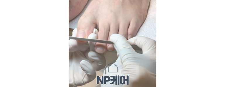 김해시 내성발톱