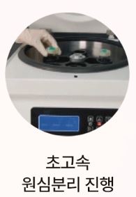 무릎줄기세포주사 가격 및 무릎줄기세포주사 실비 실손 보상 / 전국 병원추천