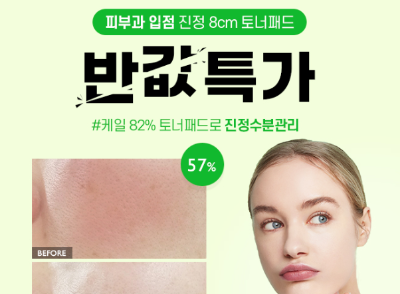 캐시닥 스마트스토어 토너패드 퀴즈 썸네일
