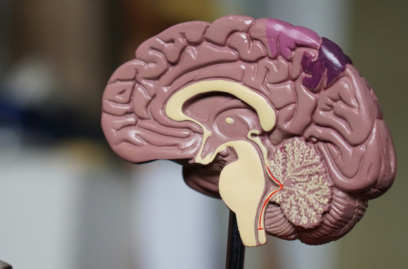 치매 예방을 위한 음악 치료 - 연구 결과와 실전 적용법