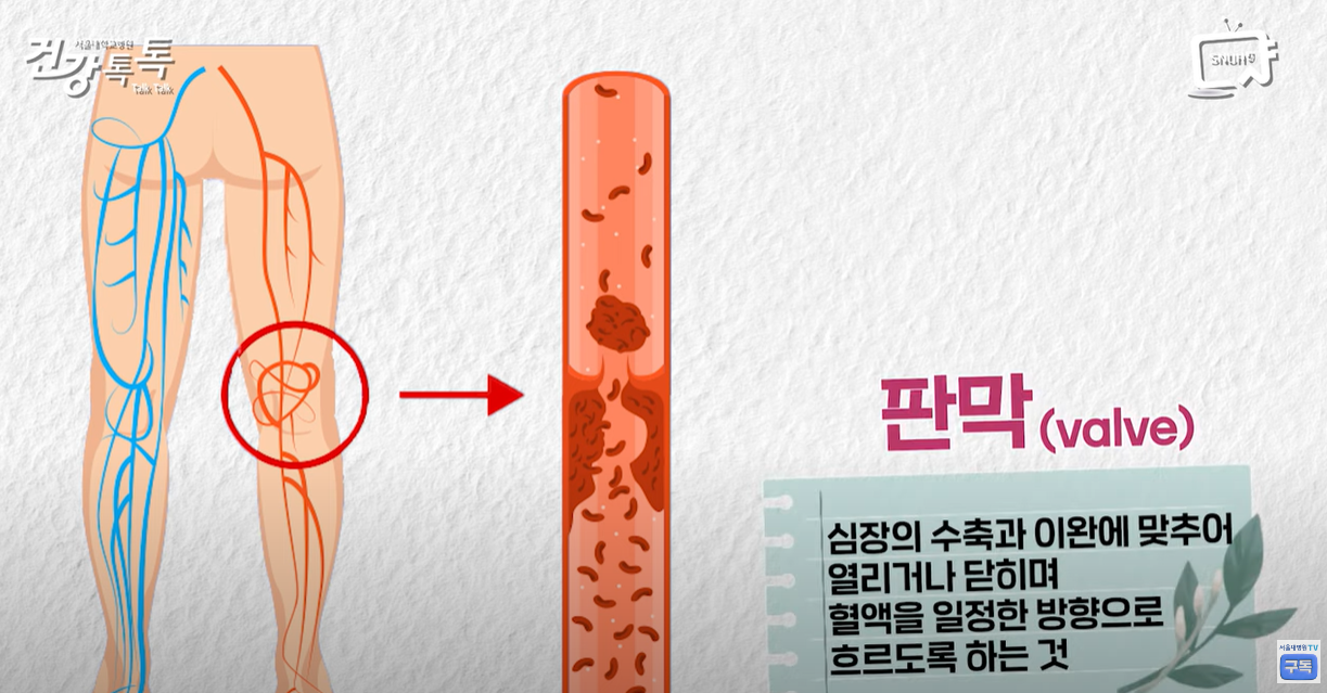 혈관에는 판막이 존재.