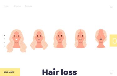 여성 탈모의 종류