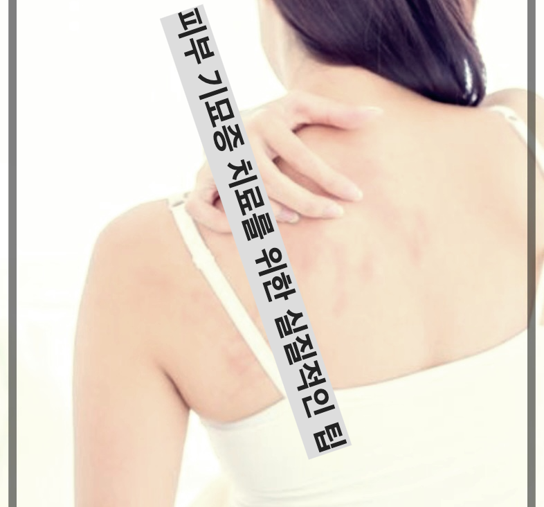 피부 기묘증 치료를 위한 실질적인 팁