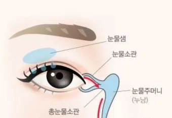 눈물이 자주 나는 이유에 대한 안과정보_21