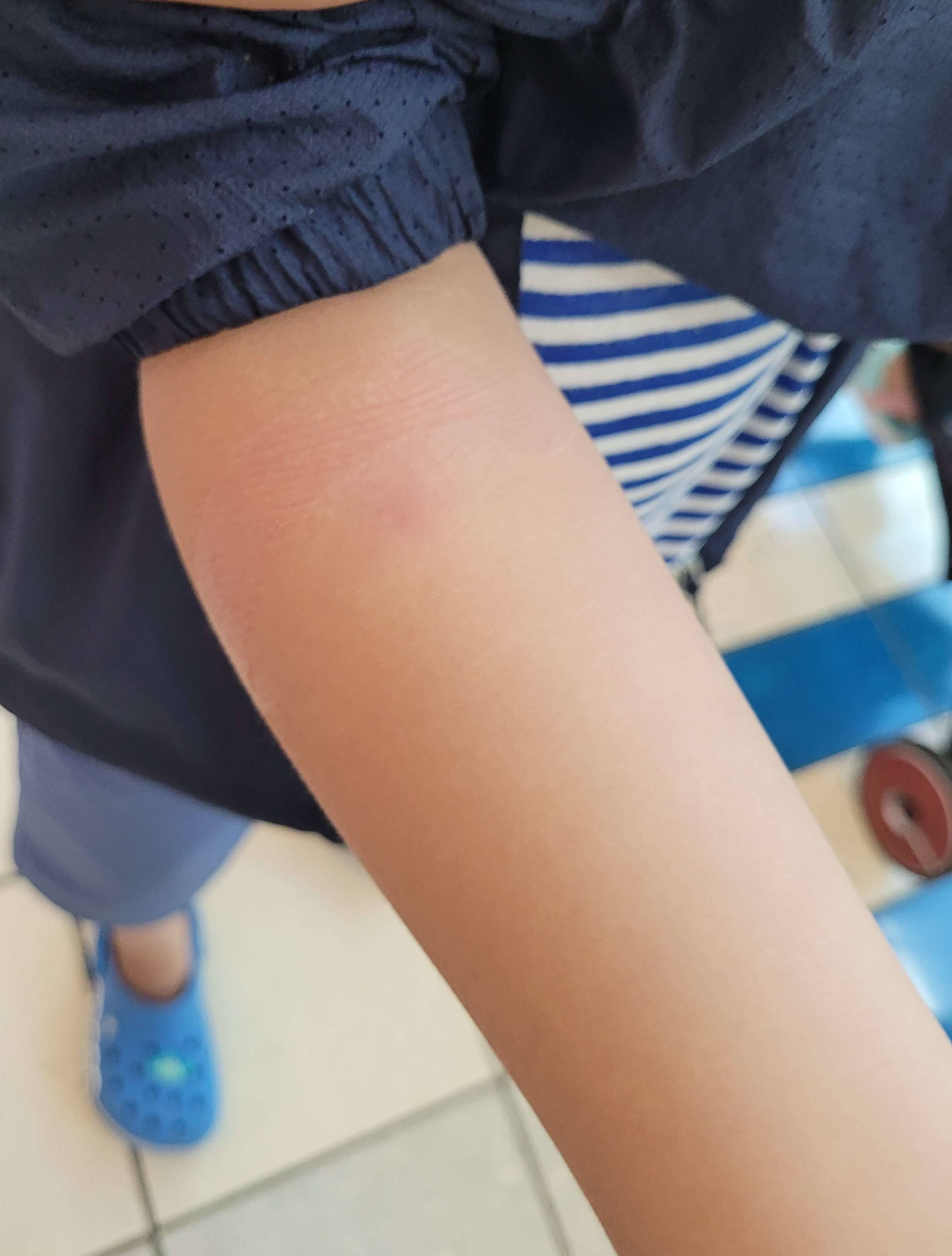 이상반응없는 모습