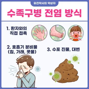 수족구 어른 전염에 대한 원인과 예방법 정리_11