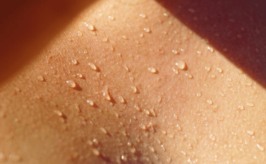 햇빛에 비친 피부에서 땀이 흐르고 있다