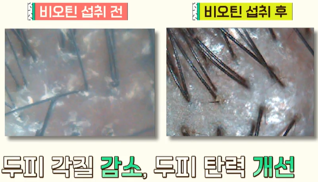 비오틴 효능